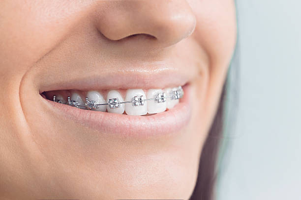 Best Wisdom Tooth Removal  in Colfax, LA